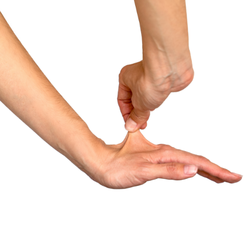 Ehlers-Danlos Syndrome-Limits-Physical-Therapy-Herriman-Eagle-Mountain-South-Jordan-UT